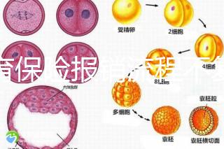 生育保險(xiǎn)報(bào)銷流程不復(fù)雜，辦理地點(diǎn)不分地域異地可報(bào)銷