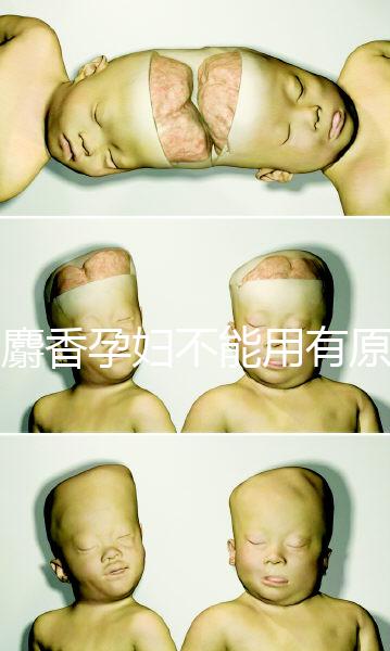 白麝香孕婦不能用有原因，流產、早產…這些危害不得不知