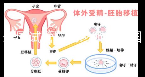 美國試管嬰兒診所（美國試管嬰兒診所排名）