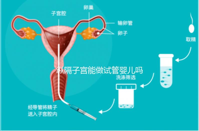 縱隔子宮能做試管嬰兒嗎?醫生:可以做，但要手術治療再進周