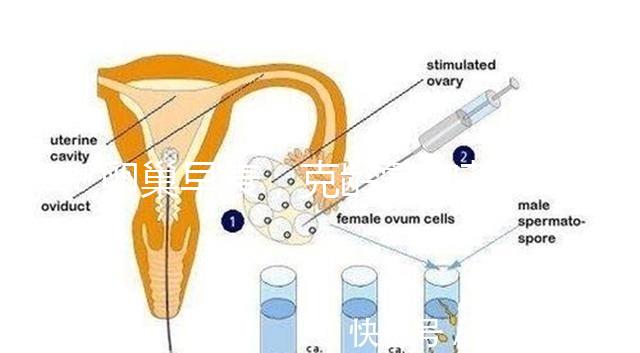 卵巢早衰，克齡蒙和芬嗎通藥物選擇引爭議