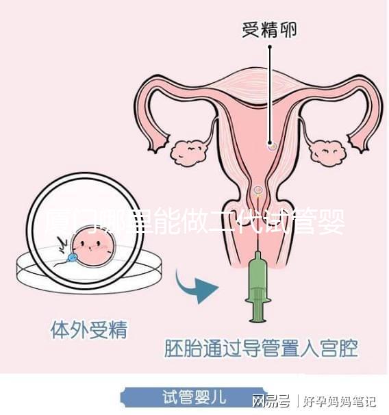 廈門哪里能做二代試管嬰兒，做一次成功率和費用多少？