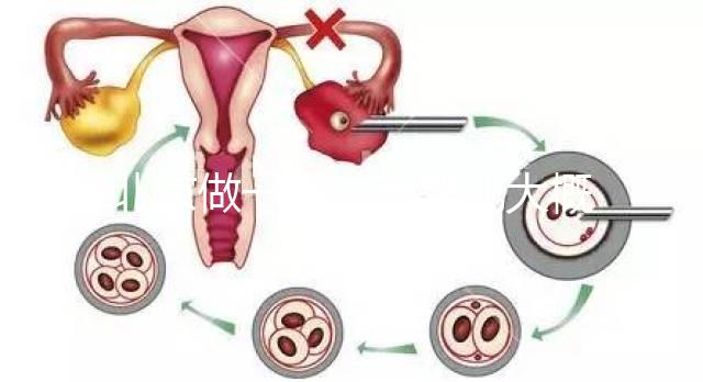 北京做一次試管嬰兒大概花多少錢？2025年價格及明細清單一覽！