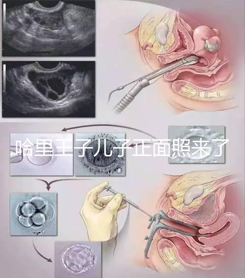 哈里王子兒子正面照來了,梅根評(píng)價(jià):氣質(zhì)甜美,乖巧