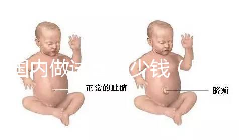 國內(nèi)做試管多少錢(國內(nèi)做試管多少錢啊)