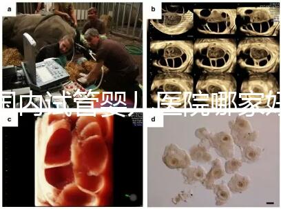 國內試管嬰兒醫院哪家好？慈銘博鰲深受患者信賴