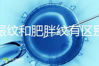 妊娠紋和肥胖紋有區別，教你3種“花紋”診斷鑒別的方法