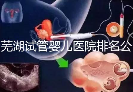 蕪湖試管嬰兒醫院排名公開，弋磯山醫院、蕪湖二院獲好評