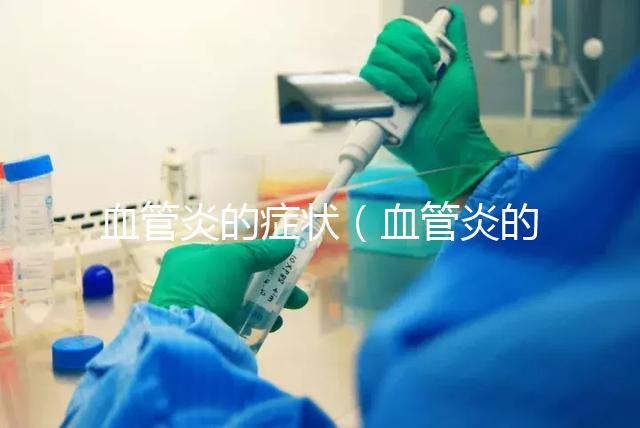 血管炎的癥狀（血管炎的癥狀有哪些）