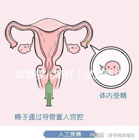 試管嬰兒哪好（試管嬰兒權威醫院哪家最好）