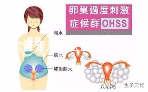 試管嬰兒要去醫(yī)院幾次（試管嬰兒要去醫(yī)院幾次？）