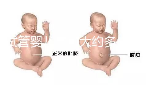 試管嬰兒費用大約多少2021年(試管嬰兒費用大約多少2021年鄭州)