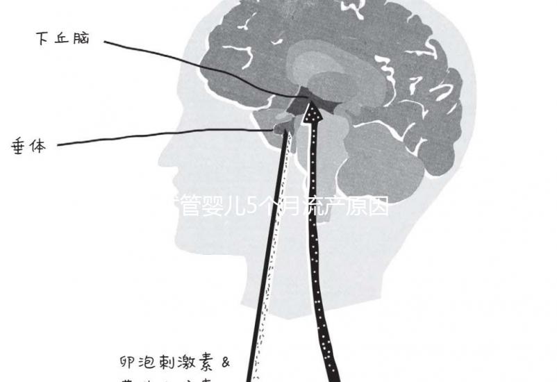 試管嬰兒5個月流產原因有三，多久能再次移植需慎重考慮