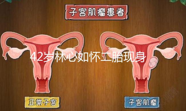 42歲林心如懷二胎現身新活動,霍建華全程陪同產檢回應
