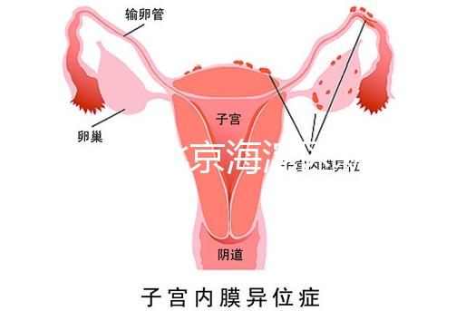 2024年北京海淀區新生兒醫療保險處理策略，照片要求不要出錯