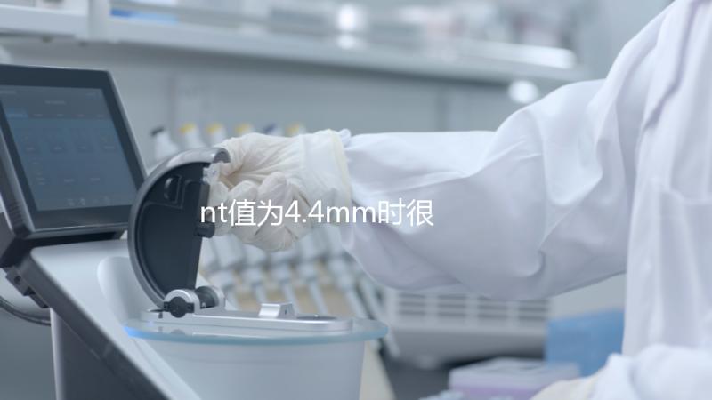 nt值為4.4mm時很危險，及時羊穿確認胎兒畸形很重要